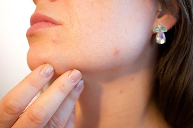 Top Non-Comedogenic Makeup Brands to Consider